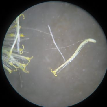 microscopic photo of California Everlasting peripheral disk floret