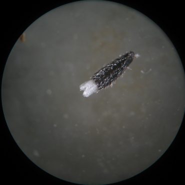 microscopic view of black seed